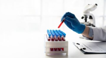 OMS actualiza su lista de pruebas diagnósticas esenciales conoce los cambios