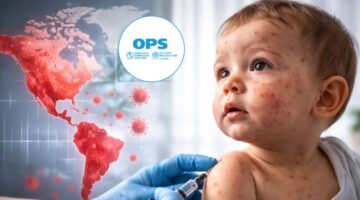 OPS advierte persistencia de brotes de sarampión en las Américas y pide reforzar vacunación y vigilancia