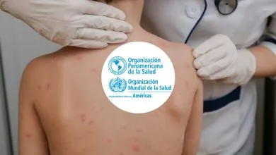 OPS alerta sobre la pérdida del estatus de eliminación del sarampión en las Américas y pide reforzar la vacunación