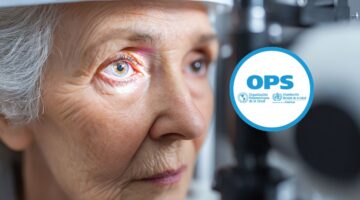 La OPS impulsa inversión en salud ocular y atención primaria para eliminar la ceguera evitable