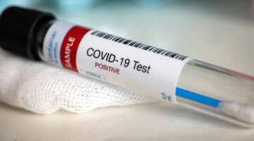 Optimizado el sistema de diagnóstico de Covid-19 en la capital