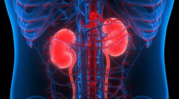Papel de la nefrectomía en cáncer renal metastásico en la era moderna