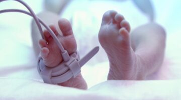 Perú reporta aumento en nacimientos de bebés prematuros