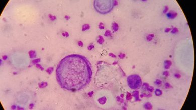 Pfizer BioNTech inicia estudio de vacunas ARNm contra el herpes zóster