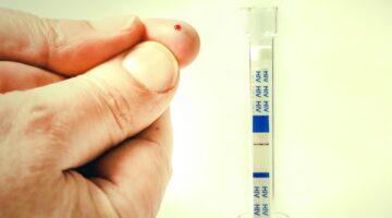 Por la pandemia habrá escasez de antirretrovirales para tratar el VIH