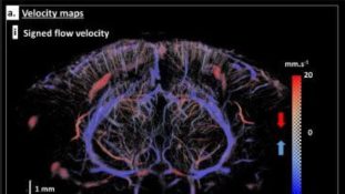 Por primera vez observan órganos completos con ecografía 3D