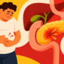 Obesidad y pancreatitis aguda: gravedad y falla orgánica