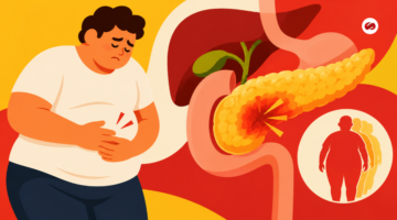 Obesidad y pancreatitis aguda: gravedad y falla orgánica
