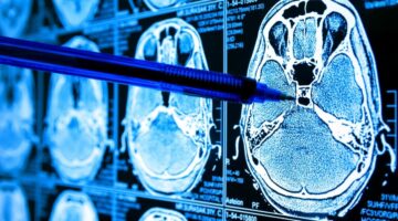 Precisión médica la hoja de ruta del sector salud