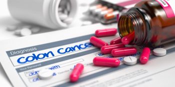 Primer fármaco que bloquea la expansión de cáncer de colon