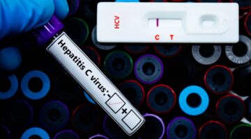 Primera prueba de autodiagnóstico de la hepatitis C ha sido precalificada por la OMS