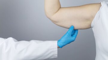 Procedimientos estéticos: Nueva normativa y protección constitucional en el sector salud