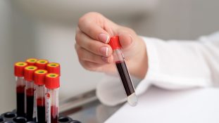Qfitlia: La FDA aprueba el primer tratamiento de ARN para la hemofilia