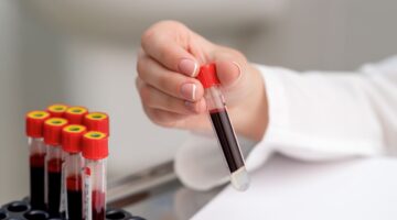 Qfitlia: La FDA aprueba el primer tratamiento de ARN para la hemofilia