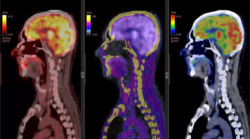 Radiofármacos BPER - nuevo plazo Resolución 529 de 2023