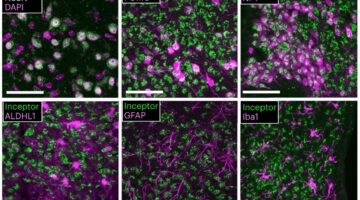 Receptores de insulina en diabetes tipo 2 enfoque prometedor