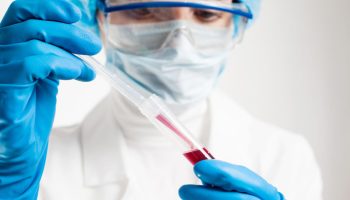 Recomendaciones Para Pacientes Hemofilia y Otras Deficiencias de la Coagulación en Época de Pandemia COVID 19