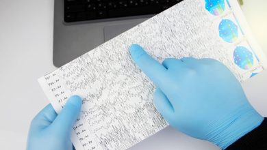 Riesgo de muerte prematura se duplica en personas con epilepsia