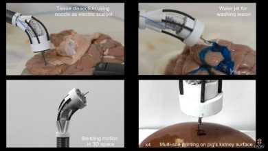 Robot hace bioimpresión 3D dentro del cuerpo humano