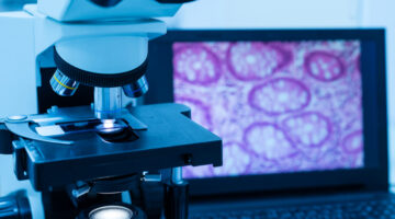 Roche abre acceso plataforma digital analisis imagenes