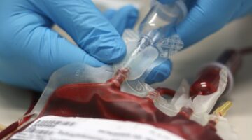 TRANSFUSION SANGRE