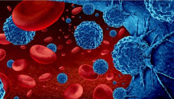 Terapias avanzadas en hematología, retos y recomendaciones para Colombia el caso Mieloma Múltiple