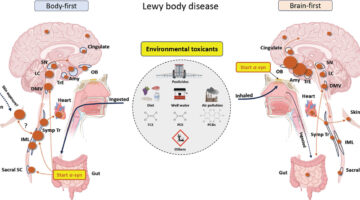 Toxinas en el ambiente ¿detonantes de la enfermedad de Parkinson