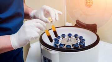 Tratamiento con plasma