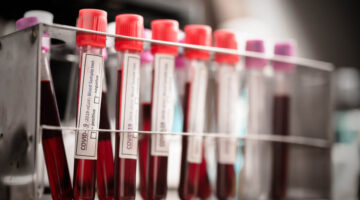Tratamiento de pruebas Covid-19 en los laboratorios del país