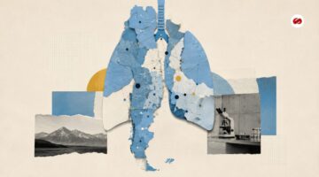 Tuberculosis en Argentina los casos incidentes aumentaron por quinto año consecutivo y llegaron a 16.359 en 2025