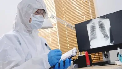 Un nuevo biomarcador TTF-1 optimiza el uso de inhibidores KRAS en cáncer de pulmón