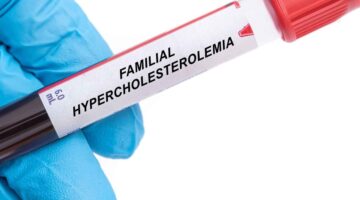 Una revolución en la genética: terapia única para la hipercolesterolemia familiar