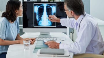 Vigilancia del cáncer de pulmón después de tratamiento con intención curativa