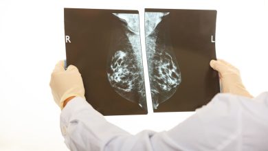 Vinculan 17 genes a la remisión en cáncer de mama triple negativo