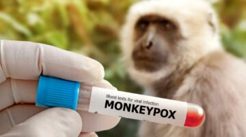 Medical,Worker,Holds,A,Test,Tube,With,Monkeypox,Virus,Infected