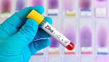 Estudio sobre el Zika