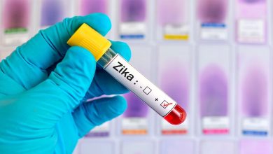 Estudio sobre el Zika