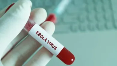 Virus del ébola podría reaparecer en el organismo y persistir después del tratamiento