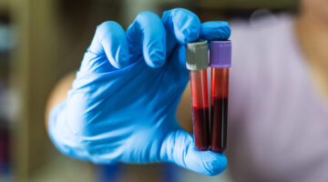 abece de la hemofilia en Colombia