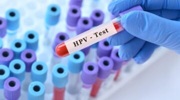 Alianza para fortalecer la inmunización contra el VPH en Cali
