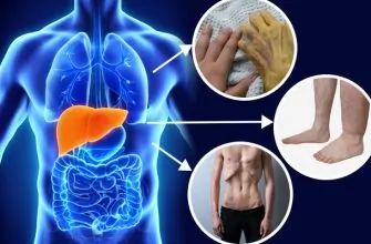 IFARMA solicitó respuesta de Minsalud por medicamentos para hepatitis C