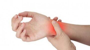 ARTRITIS REUMATOIDE