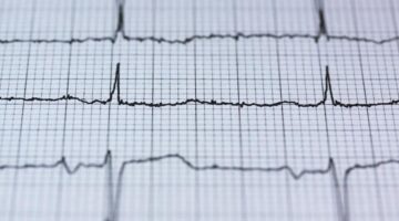 cambian tasas muerte prematura nivel mundial