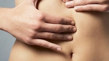 Cáncer de Colon y recto