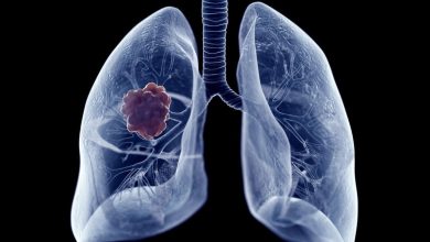 cancer de pulmón Nivolumab más ipilimumab
