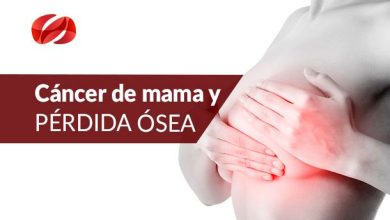 Cáncer de mama y pérdida ósea