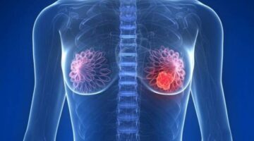 Crean nanodispositivos para tratamiento de cáncer de mama