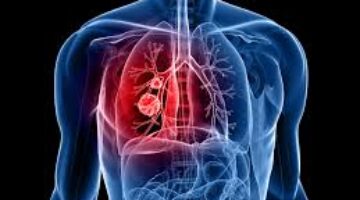 Nueva Terapia inmunológica contra el cáncer