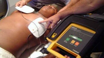 Reanimación Cardiopulmonar