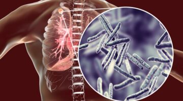 comprueban eficacia medicamento antituberculosis